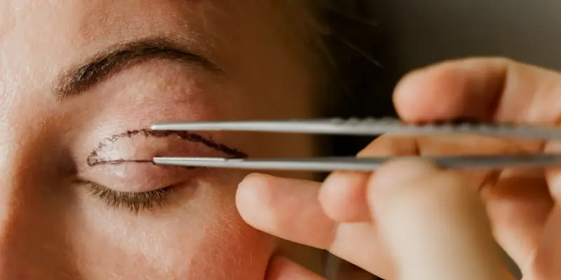 ankara göz kapağı estetiği